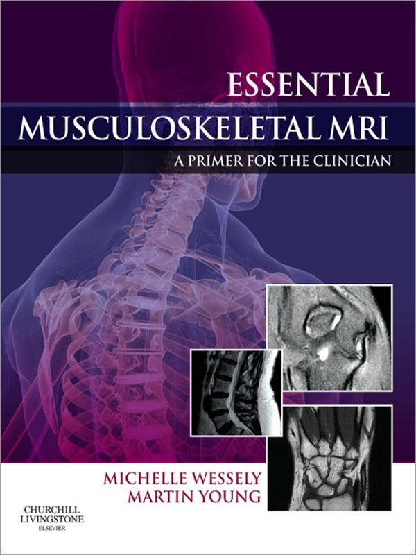 Essential Musculoskeletal Mri E-Book (ebook) · Medicina General · El ...