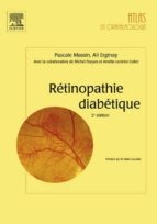 RÉTINOPATHIE DIABÉTIQUE RÉTINOPATHIE DIABÉTIQUE