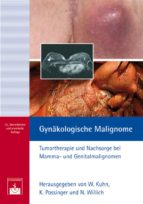 GYNÄKOLOGISCHE MALIGNOME GYNÄKOLOGISCHE MALIGNOME