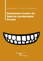 Endodoncia Clinica en dientes con necrosis pulpar
