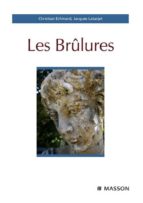 LES BRÛLURES LES BRÛLURES