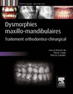 DYSMORPHIES MAXILLO-MANDIBULAIRES DYSMORPHIES MAXILLO-MANDIBULAIRES