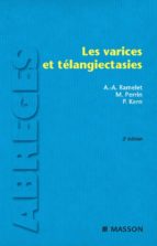 LES VARICES ET TÉLANGIECTASIES LES VARICES ET TÉLANGIECTASIES