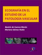 Ecografía en el estudio de la patología vascular