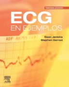 ECG EN EJEMPLOS ECG EN EJEMPLOS
