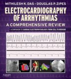 ELECTROCARDIOGRAPHY OF ARRHYTHMIAS: A COMPREHENSIVE REVIEW E-BOOK ELECTROCARDIOGRAPHY OF ARRHYTHMIAS: A COMPREHENSIVE REVIEW E-BOOK