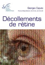 DÉCOLLEMENTS DE RÉTINE DÉCOLLEMENTS DE RÉTINE