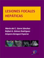 Lesiones focales hepáticas