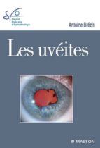 LES UVÉITES LES UVÉITES